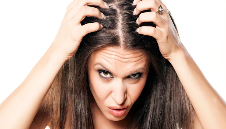 बरसात में पैदा होती है जूं की समस्या, इन नुस्खों की मदद से पाए निजात