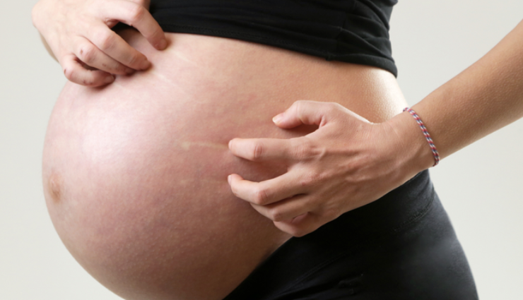 pregnancy itchy belly remedies,home remedies for itchy pregnant belly,treating itchy belly during pregnancy at home,natural remedies for pregnancy belly itch,alleviating itchy stomach during pregnancy,pregnancy belly itching home treatments,relieving itchy pregnant belly naturally,soothing remedies for itchy belly in pregnancy,home care for itchy belly during pregnancy,pregnancy belly itch relief remedies,natural relief for pregnancy belly itch,remedies for itching during pregnancy,soothing itchy belly in pregnancy,pregnancy belly itching remedies,alleviating pregnancy belly itch naturally,home treatments for itchy pregnant belly,natural remedies for pregnancy itchiness,pregnancy belly care tips,calming itchy stomach in pregnancy,diy remedies for pregnancy belly itch