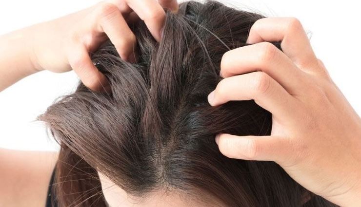 itchy scalp,home remedies,home remedies for itchy scalp,hair care tips,beauty tips