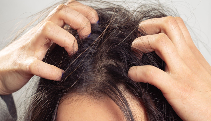 10 Home Remedies To Treat Dry Itchy Scalp
