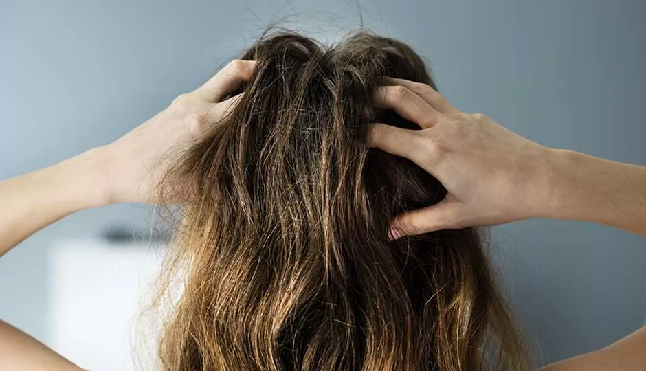 12 Home Remedies To Treat Itchy Scalp