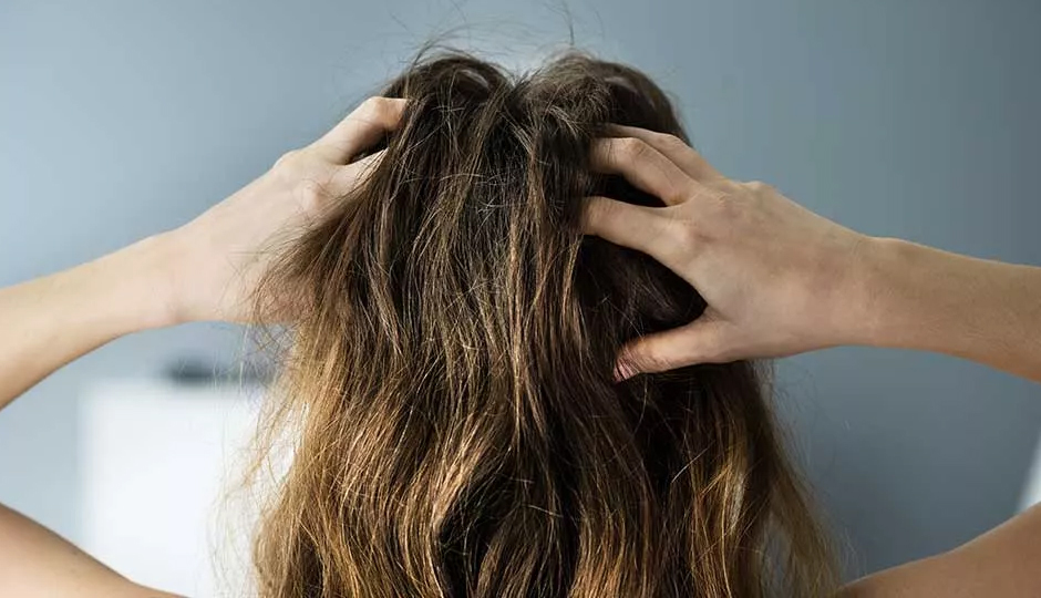 7 Effective Home Remedies To Treat Itchy Scalp in Winters