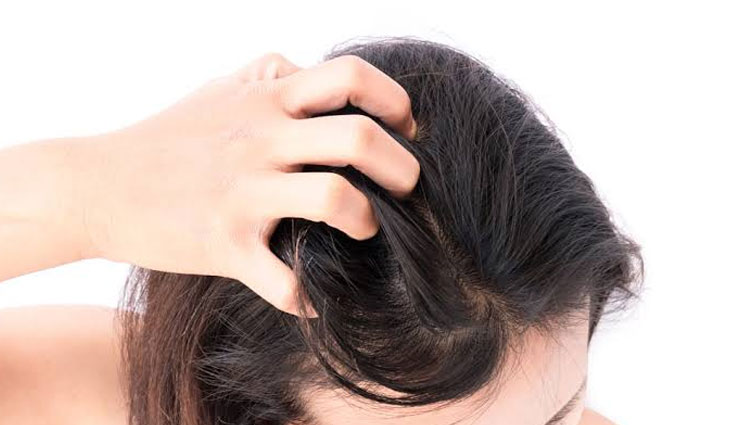 home remedies,home remedies for itchy scalp,itchy scalp,hair care tips,beauty tips,skin care tips