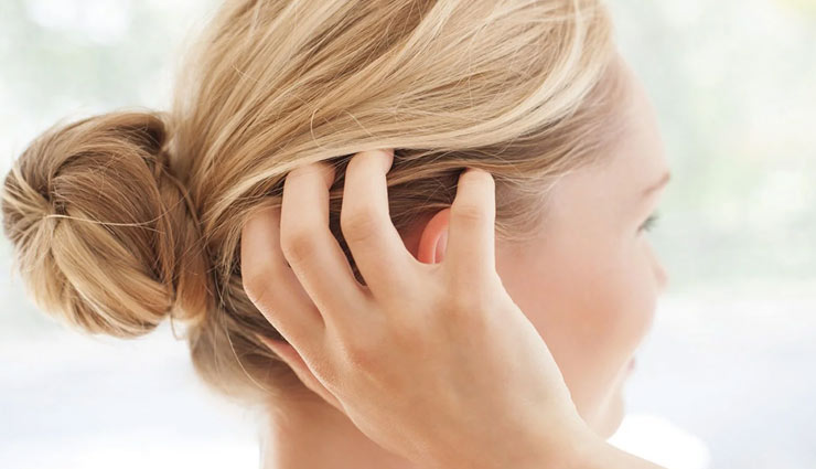 itchy scalp,home remedies,home remedies for itchy scalp,hair care tips,beauty tips