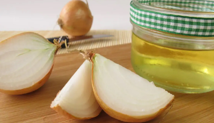 coconut oil,tea tree oil,apple cider vinegar,aloe vera,peppermint oil,onion juice,natural remedies,natural remedies for itchy scalp,monsoon beauty tips,beauty tips,hair care tips