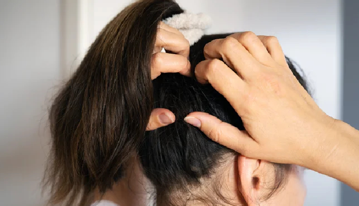 6 Must Try Home Remedies To To Treat Itchy Scalp