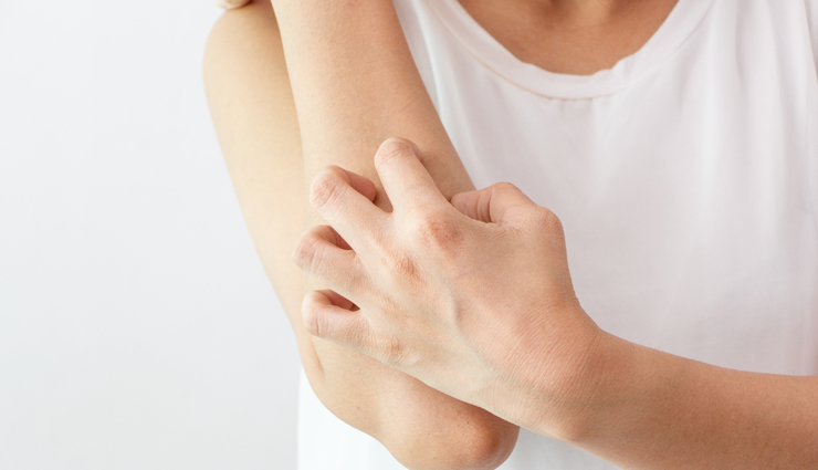 5 Natural Treatment for Itchy Skin