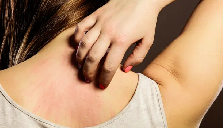 7 Effective Home Remedies To Treat Itchy Skin
