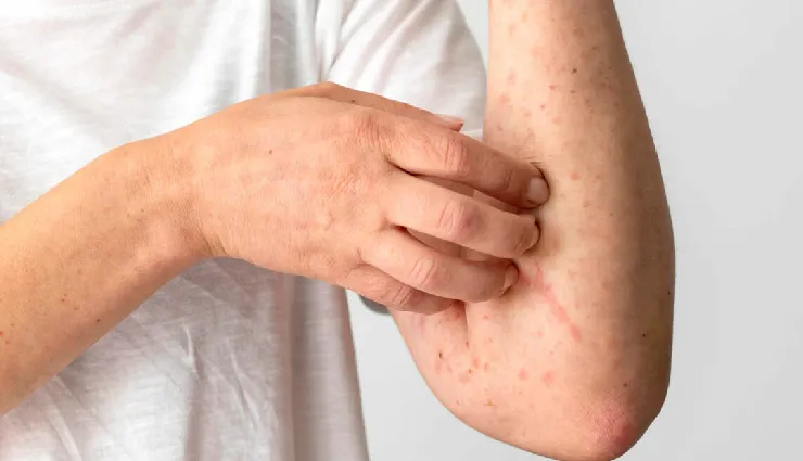 early signs of liver damage,symptoms of liver failure,causes of liver disease,liver health tips,hepatitis b and c effects,cirrhosis symptoms,alcohol-related liver damage,malnutrition and liver health,how to protect liver,warning signs of liver problems