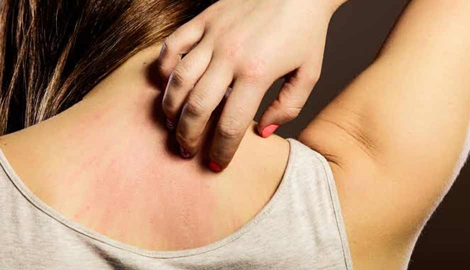 12 Home Remedies to Treat Itchy Skin