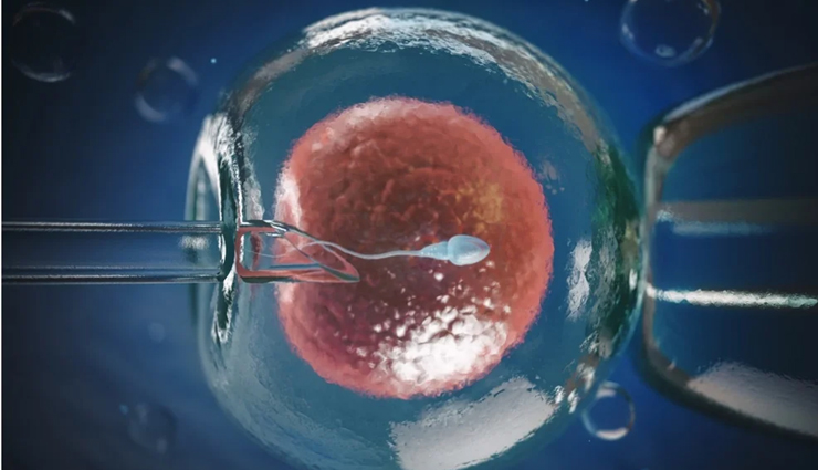 ivf,in vitro fertilization,fertility treatment,infertility,reproductive health,family planning,success rates,cost of ivf,emotional impact,physical demands,fertility clinic,pre-treatment evaluations,medical history,lifestyle changes,multiple pregnancies,fertility medication,assisted reproductive technology,ivf risks,ivf benefits,ivf process