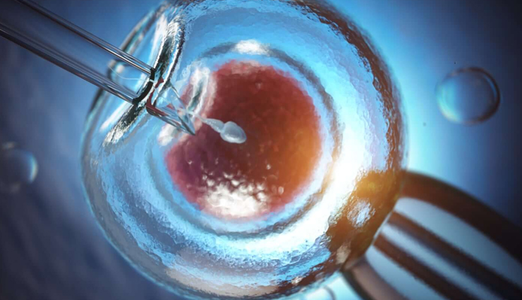 7 Things To Consider Before You Choose IVF