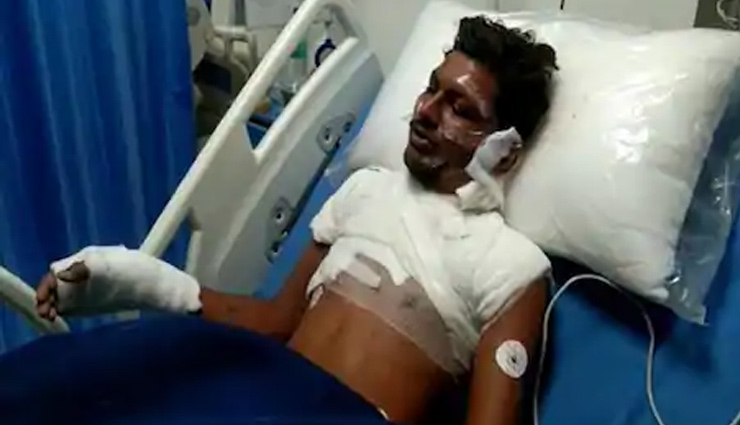 जालोर / मामूली कहासुनी के बाद दलित युवक पर पेट्रोल छिड़क कर लगा दी आग, 50 फीसदी झुलसा 