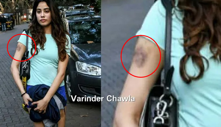 हादसे का शिकार हुई जान्हवी कपूर, हाथ पर दिखे चोट के निशान, वायरल हुई ये तस्वीर