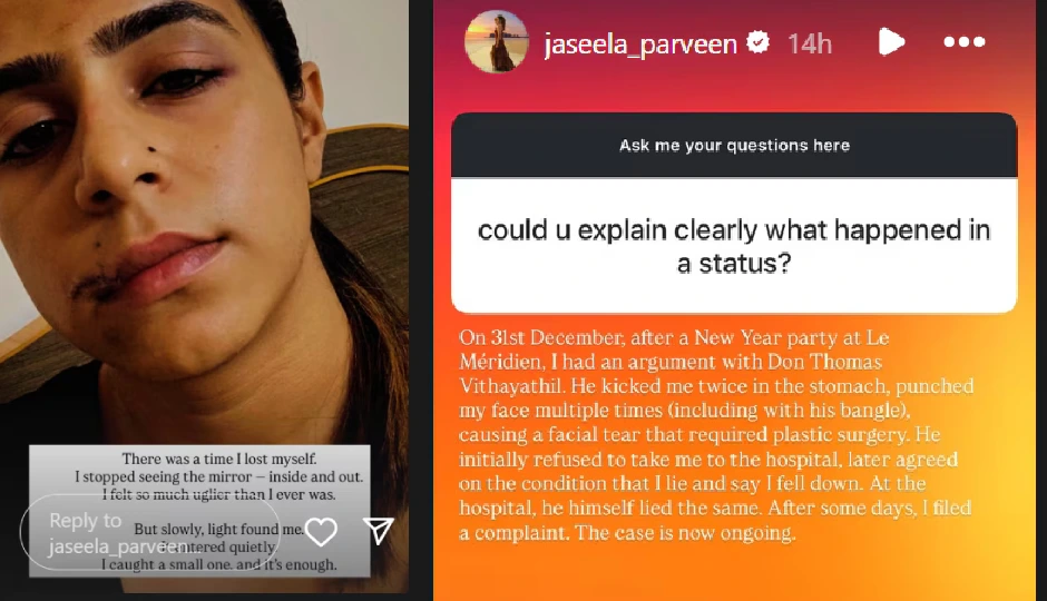 malayalam actress jaseela news,jaseela ex boyfriend assault,jaseela physical abuse case,don thomas jaseela controversy,malayalam tv actress abuse story,jaseela instagram post,jaseela plastic surgery reason,jaseela domestic violence case