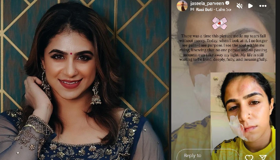 चेहरे पर मुक्का, पेट पर लात... मलयालम अभिनेत्री ने पूर्व प्रेमी पर लगाया मारपीट का आरोप