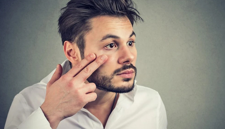 what is jaundice,jaundice causes,jaundice symptoms,jaundice treatment,jaundice,healthy living,Health tips