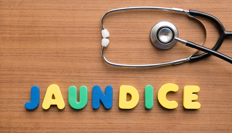 12 Home Remedies For Jaundice That are Really Effective