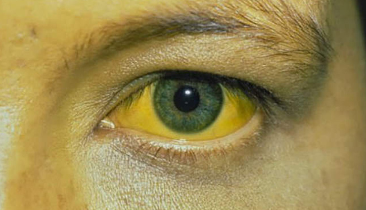 healthy living,Health,eyes,diabetes,cancer,eyes health,health news,healthy living