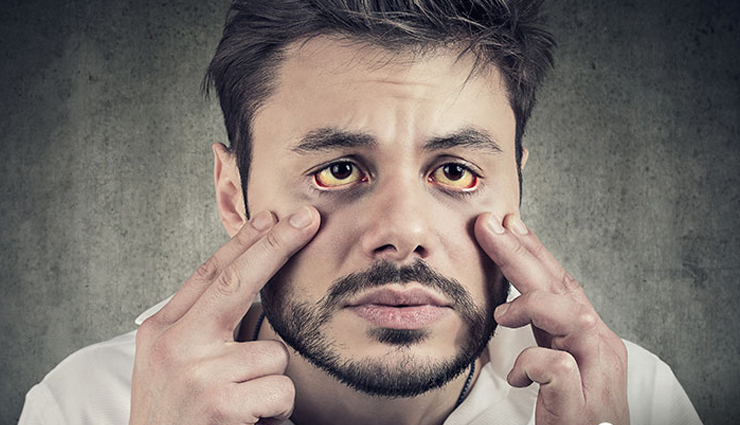 10 Liver Friendly Natural Foods To Cure Jaundice