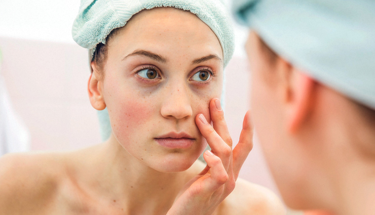 reasons and effects of jaundice,jaundice,Health tips,fitness tips