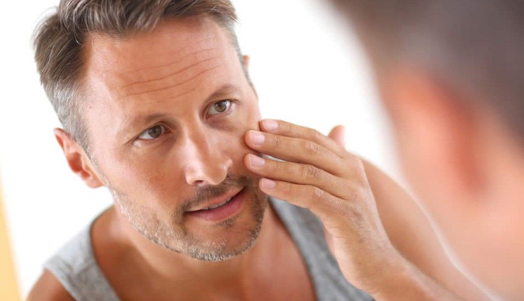 reasons and effects of jaundice,jaundice,Health tips,fitness tips