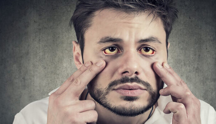 benefits of drinking coconut water,health benefits of coconut water,healthy living,Health tips