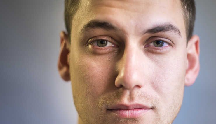 what is jaundice,jaundice causes,jaundice symptoms,jaundice treatment,jaundice,healthy living,Health tips