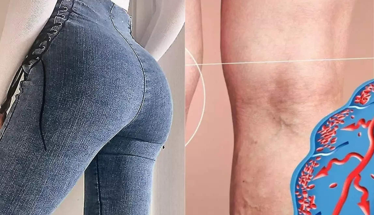 tight jeans can prove fatal for men,know its disadvantages,Health,healthy living