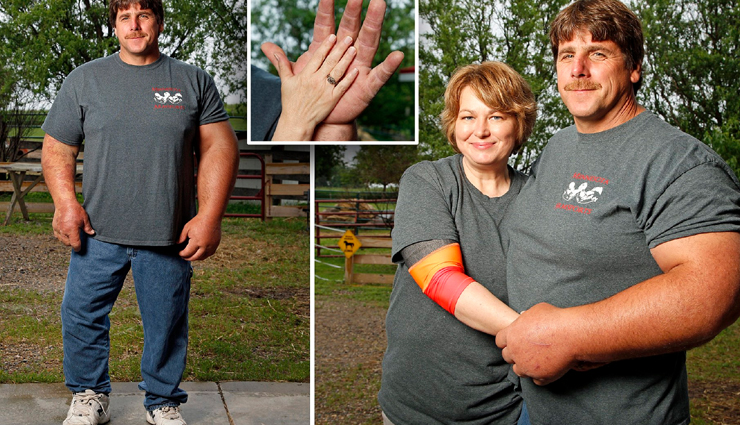 शख्स के बड़े हाथों को देख आपको भी आ जाएगी Hulk की याद, डॉक्टर भी नहीं ढूंढ पाए इसकी असली वजह