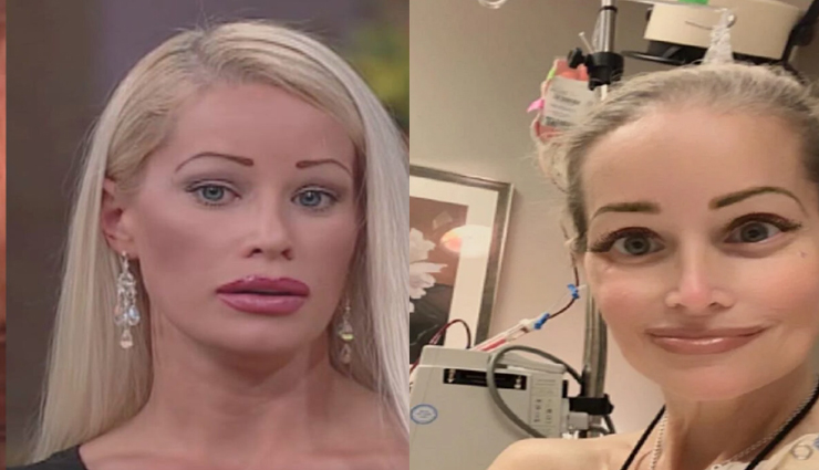 बार्बी डॉल जैसा लुक पाने के लिए यह महिला करवा चुकी अब तक 59 बार प्लास्टिक सर्जरी!