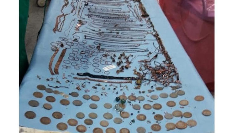 महिला के पेट से निकले 5-10 रुपये के 90 सिक्के और 1.5 किलो जूलरी west bengal,unique case,rampurhat,kolkata,jewelry in stomach,coins in stomach,birbhum,kolkata news,west bengal news in hindi,weird news,weird news in hindi