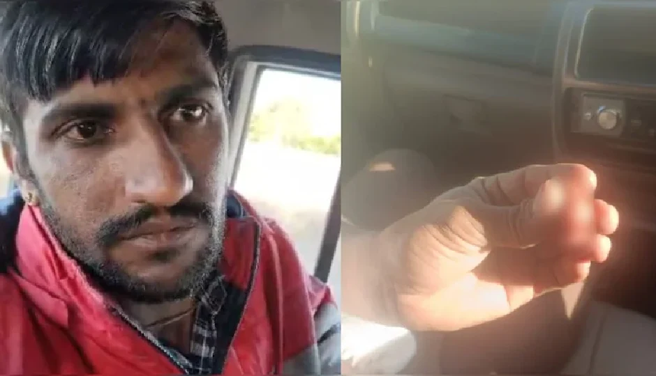 राजस्थान: जीजा ने साले की नाक काटी, पत्नी की दूसरी शादी से  था नाराज