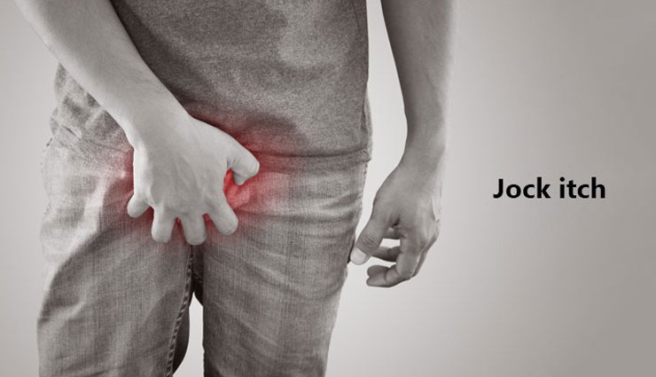 5 Home Remedies To Treat Jock Itch