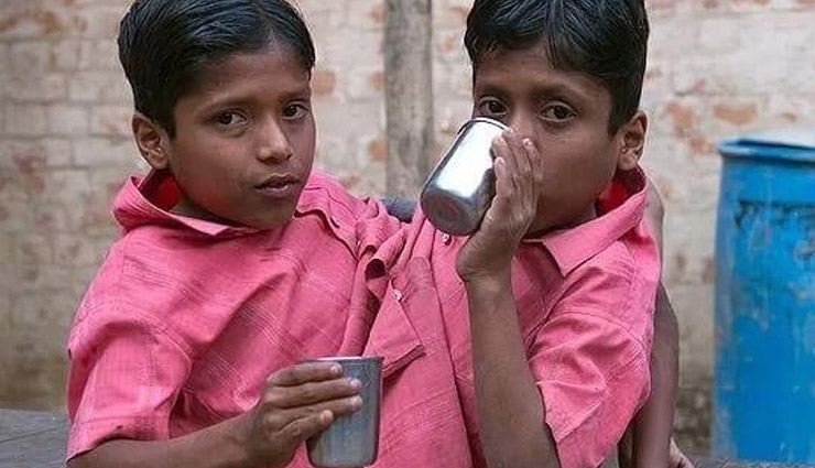 छत्तीसगढ़ : 2 सिर, 4 हाथ और एक धड़ वाले जुड़वा भाइयों की संदिग्ध परिस्थितियों में मौत, गांव में पसरा मातम