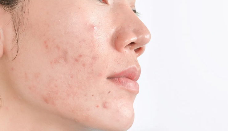 carrot and beetroot juice,health benefits of carrot and beetroot juice,healthy juice,Health tips,fitness tips