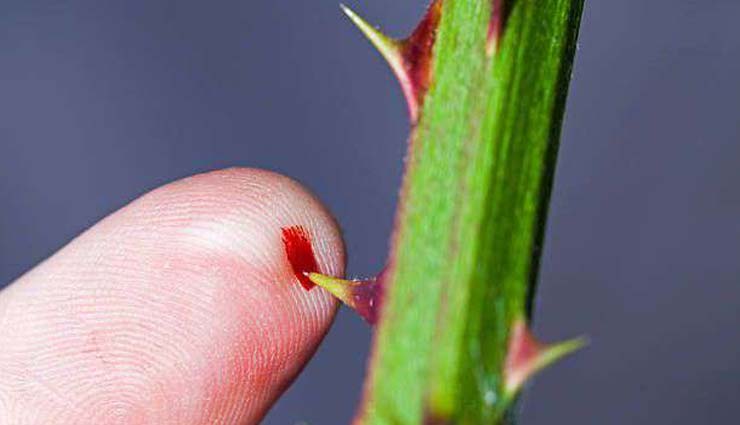 कांटे की चुभन बन सकती है इंफेक्शन का कारण, राहत पाने के लिए आजमाए ये घरेलू उपाय 