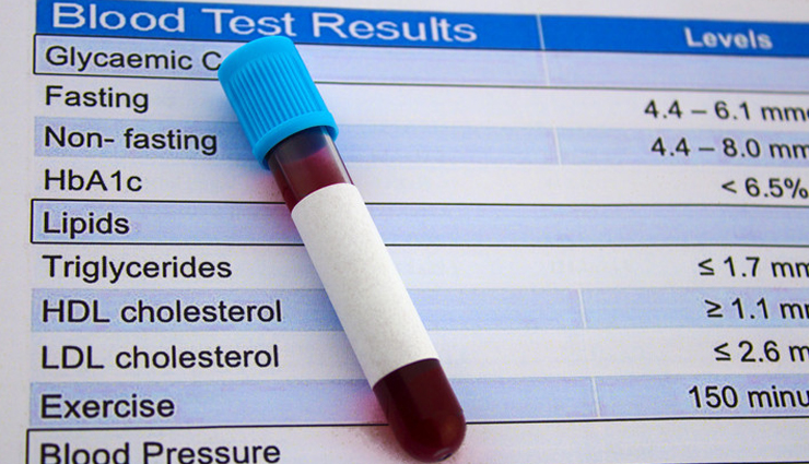 kalamata olives,greek olives,mediterranean diet,olive varieties,black olives,brine-cured olives,Olive Oil,antioxidants,healthy fats,omega-3 fatty acids,heart health,anti-inflammatory,cancer prevention,brain health,immune system,digestive health,nutrients,vitamin e,iron,calcium,magnesium,potassium,fiber,polyphenols,vegan food,gluten-free food,gourmet food,appetizers,salads,pizza toppings