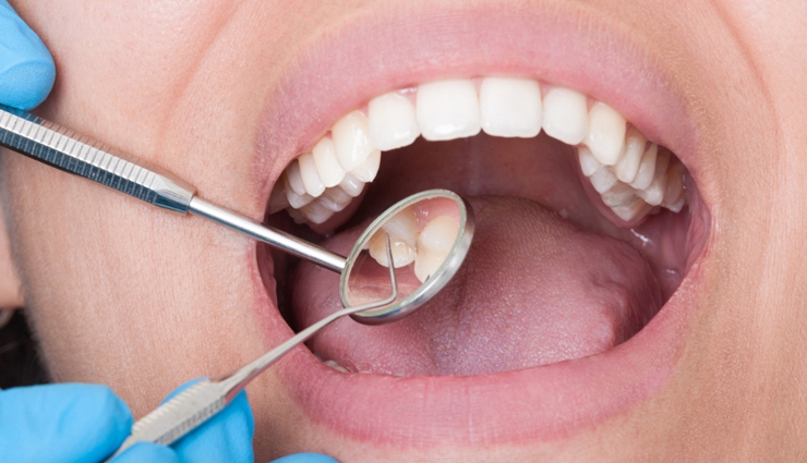 kalamata olives,health benefits of kalamata olives,Health tips,fitness tips