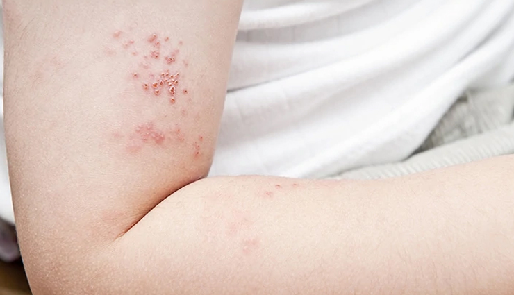 kalonji,kalonji for skin and hair,beauty benefits of kalonji,skin care tips,hair care tips