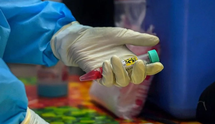 कानपुर / सरकारी शेल्टर होम की 33 कोरोना (+) लड़कियों में से 2 गर्भवती, HIV और  हेपेटाइटिस सी का भी संक्रमण, मचा हड़कंप 