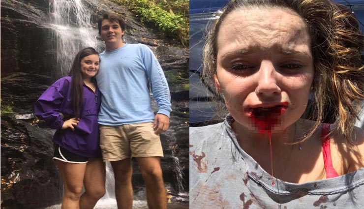 kayla,kayla ex boyfriend,weird story,lip bitten by ex