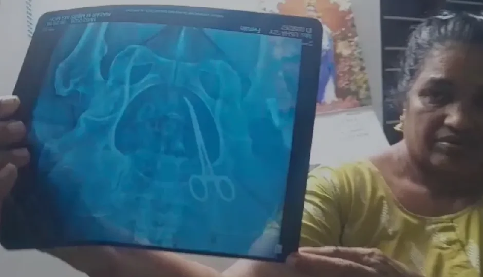 सर्जरी के बाद पांच साल तक झेलती रही असहनीय दर्द, सीटी स्कैन में पेट से निकली कैंची; केरल के सरकारी अस्पताल पर लापरवाही का आरोप