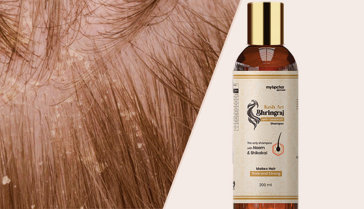 hair problems relief products,solutions for common hair issues,products to address hair problems,best hair care products for damaged hair,top products for healthy hair,effective treatments for hair concerns,hair care remedies that work,get relief from hair problems with these products,products for strong and beautiful hair,hair care essentials for problem-solving