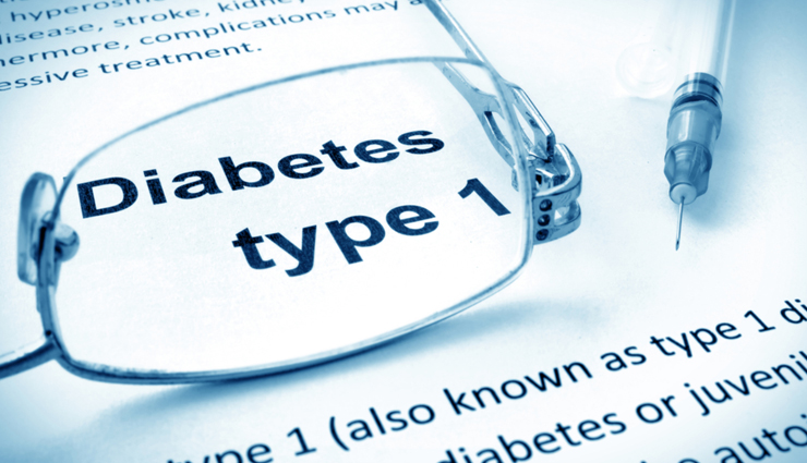 keto diet,health conditions when keto diet is not safe,health conditions,Health tips,fitness tips