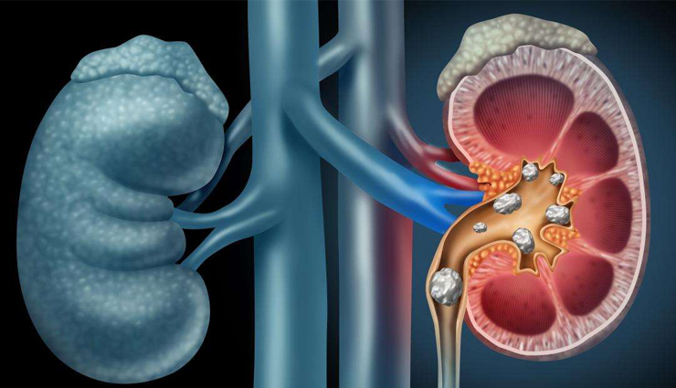 health benefits of kharbuja,kharbuja,Health tips,fitness tips