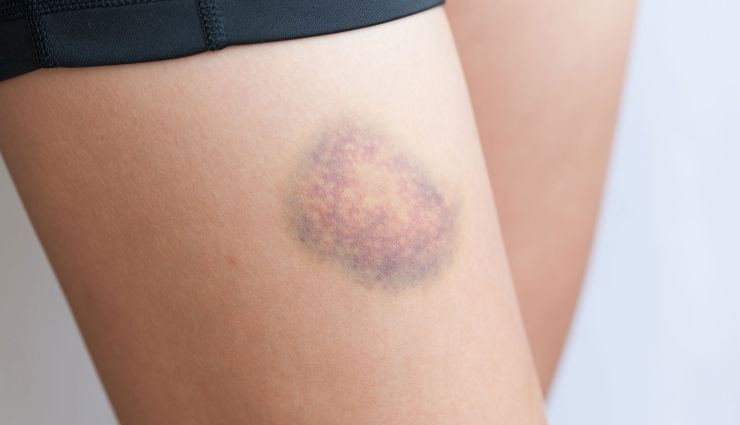 हृदय रोग, पेट के कैंसर और टाइप 2 डायबिटीज से बचाता है हरा टमाटर, सेवन से होते है और भी कई फायदे green tomato,green tomato in hindi,benefits of green tomato,healthy food green tomato,tomato benefits,healthy food,Health tips