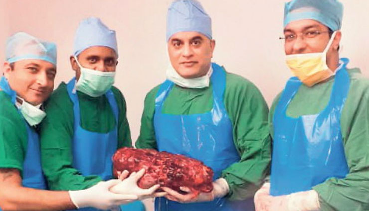 मरीज के शरीर से डॉक्टरों ने निकाली 7.4 किलो वजनी किडनी