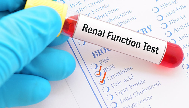 kidney health tips,tips to keep kidney healthy,Health tips,fitness tips