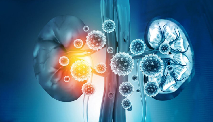 high creatinine causes,elevated creatinine levels,kidney function and creatinine,reasons for increased creatinine,renal issues and creatinine elevation,how to lower creatinine levels,managing high creatinine naturally,health risks of elevated creatinine,understanding kidney health,creatinine and kidney disease